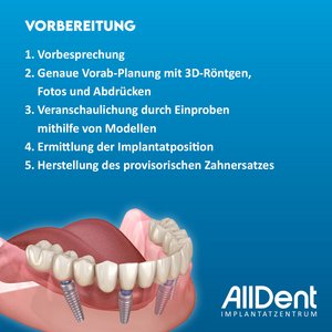 Hinweise zum OP-Tag bei der Feste dritte Zähne Behandlung