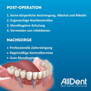 Empfehlung Feste dritte Zähne Behandlung beispielsweise für Angatspatienten