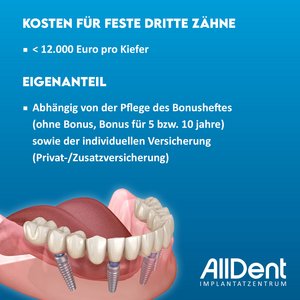 Hinweise zur OP-Vorbereitung bei festen dritten Zähnen