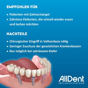 Kosten für feste dritte Zähne liegen bei <12000 Euro pro Kiefer